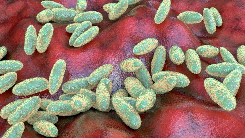 US monitoring suspected fatal pneumonic plague case in Russia, State Department official says